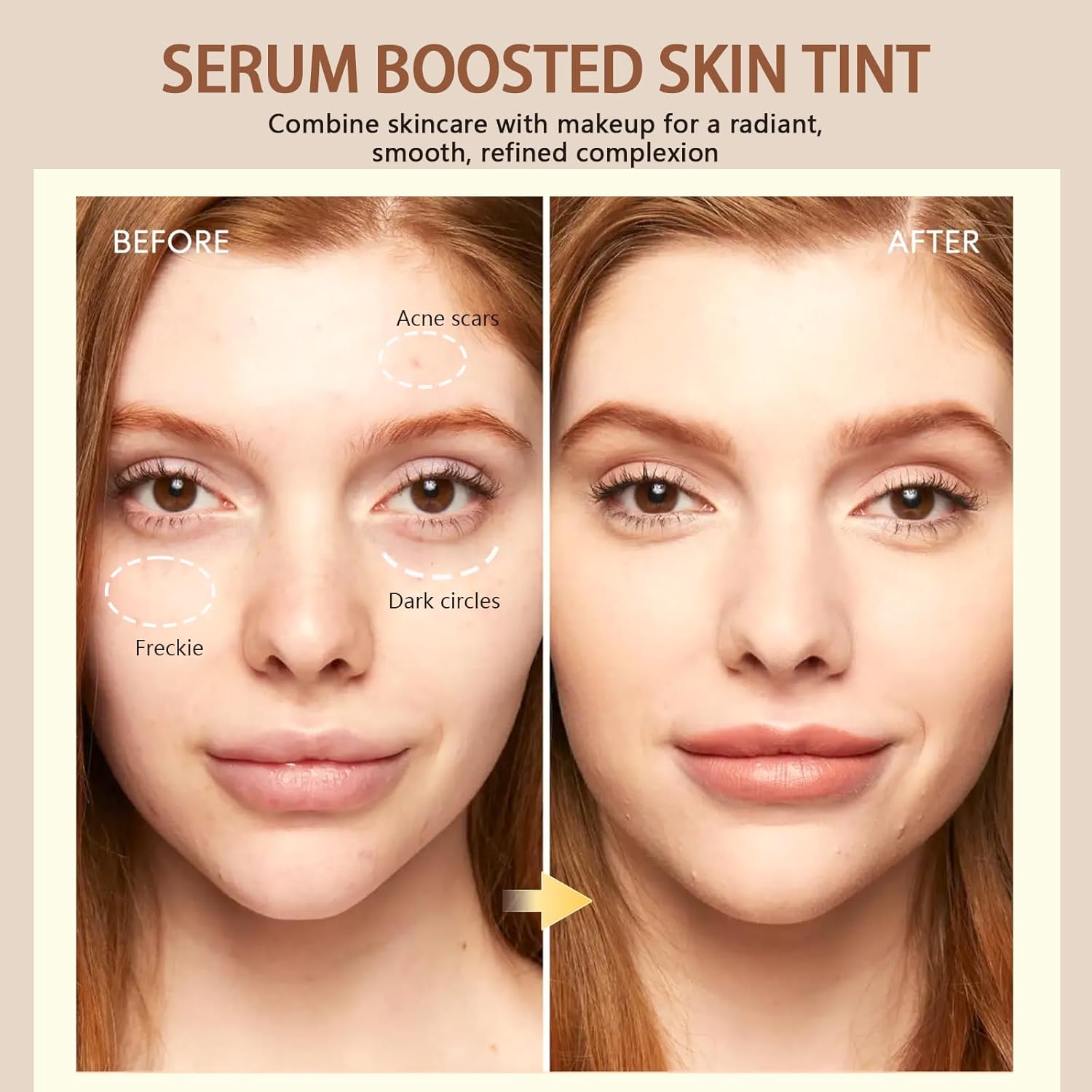 Before and after of Serum Boosted Skin Tint showing improved complexion and coverage for acne scars and dark circles.