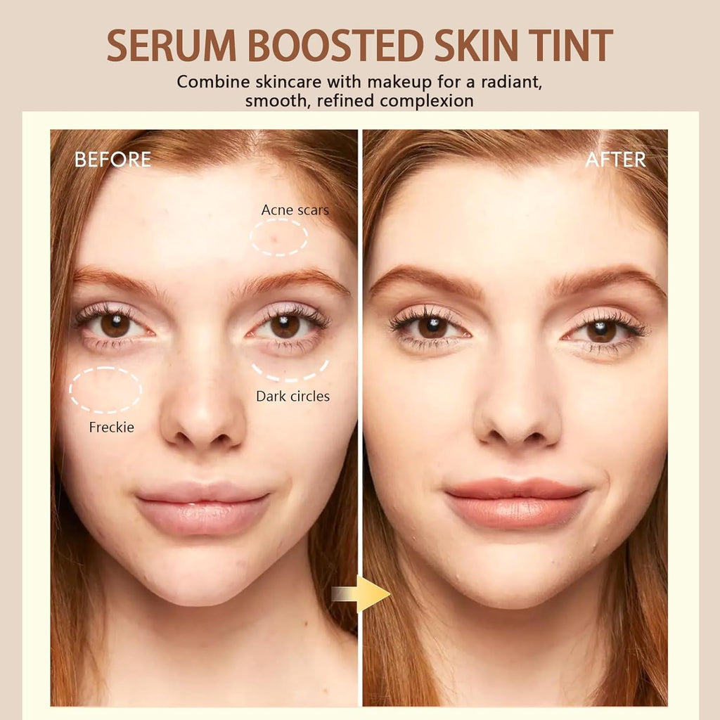 Before and after image showing results of Serum Boosted Skin Tint on skin imperfections like acne scars and dark circles.